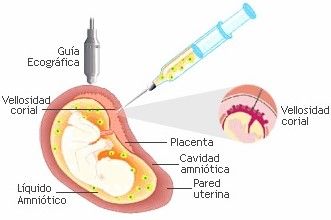 GENÉTICA. DIAGNÓSTICO PRENATAL Y TÉCNICAS INVASIVAS DE MONITORIZACIÓN FETAL. DROGAS Y MEDICAMENTOS