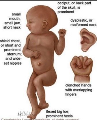 GENÉTICA. DIAGNÓSTICO PRENATAL Y TÉCNICAS INVASIVAS DE MONITORIZACIÓN FETAL. DROGAS Y MEDICAMENTOS