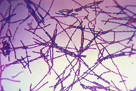 Bacterias esporuladas y no esporuladas