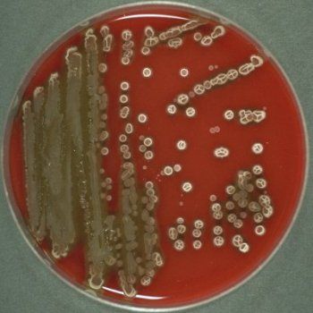 Bacterias esporuladas y no esporuladas