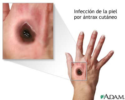 Bacterias esporuladas y no esporuladas