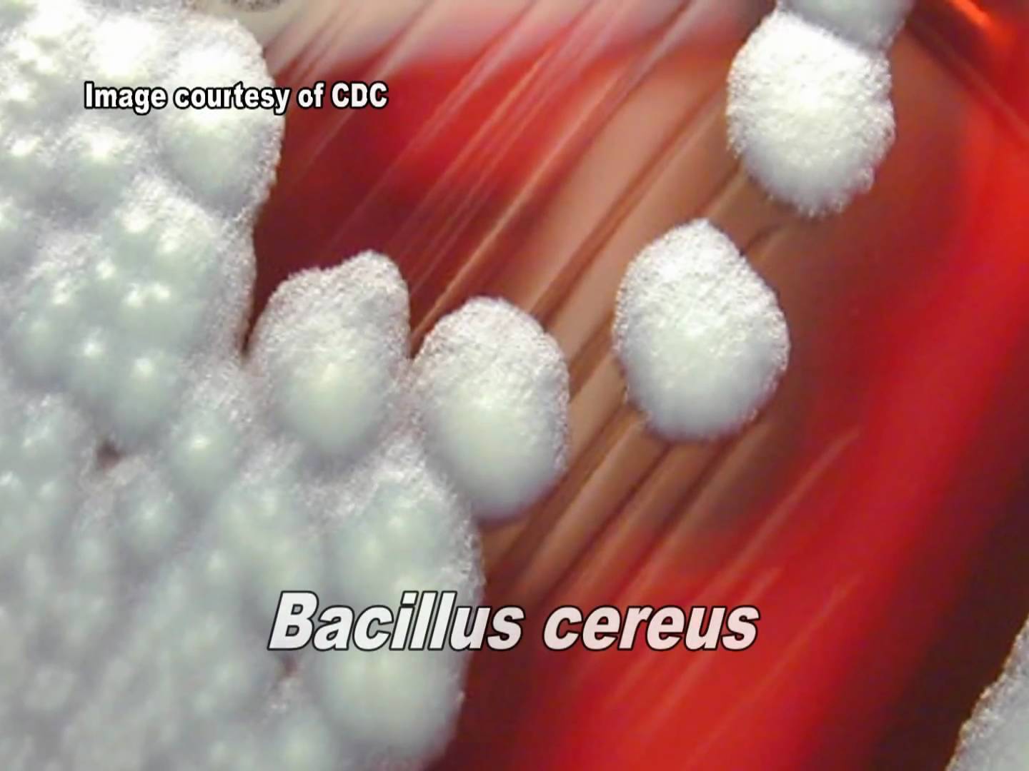 Bacterias esporuladas y no esporuladas