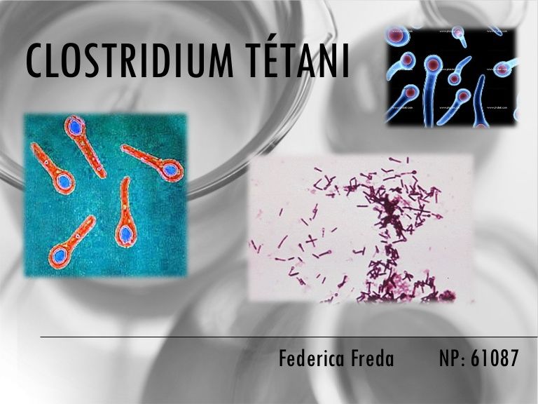 Bacterias esporuladas y no esporuladas