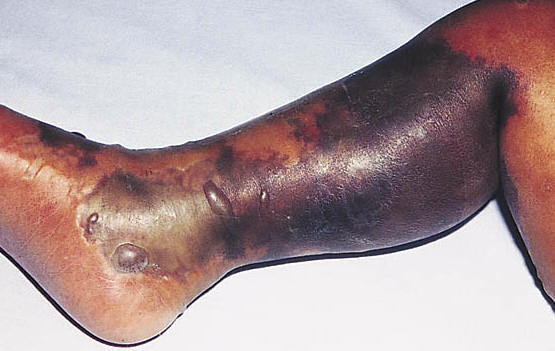 Bacterias esporuladas y no esporuladas
