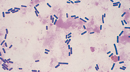 Bacterias esporuladas y no esporuladas