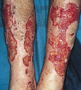 Bacterias esporuladas y no esporuladas