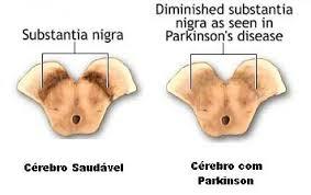 CAPACIDADE FUNCIONAL DE IDOSOS COM DOENÇA DE ALZHEIMER E PARKINSON