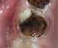 PATOLOGIA PULPAR Y PERIAPICAL EN DIENTES DECIDUOS