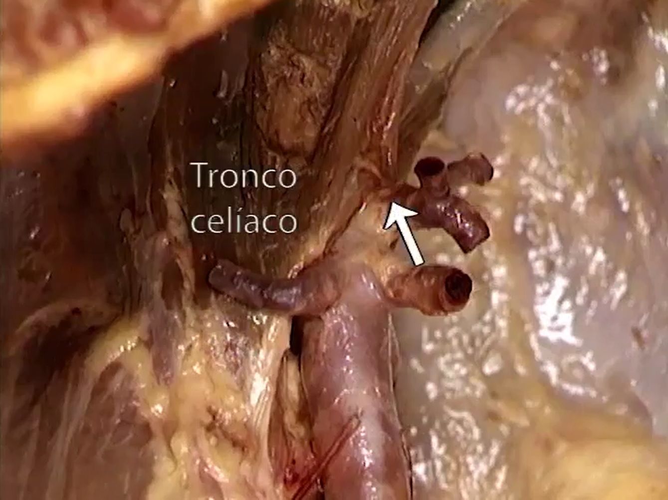 Criculación del Abdomen