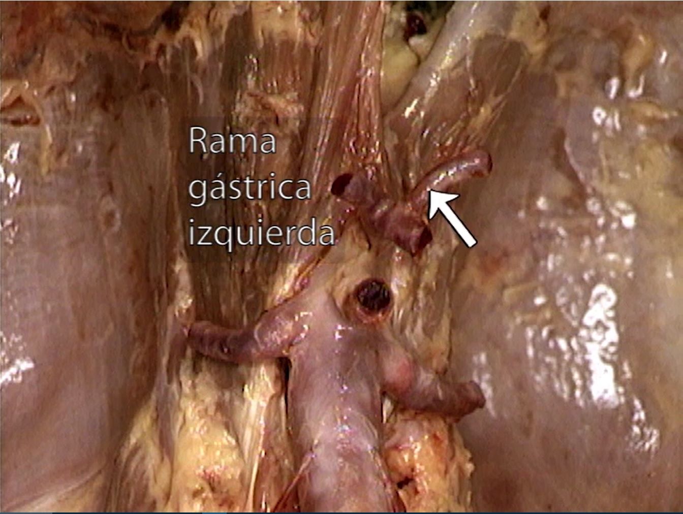 Criculación del Abdomen
