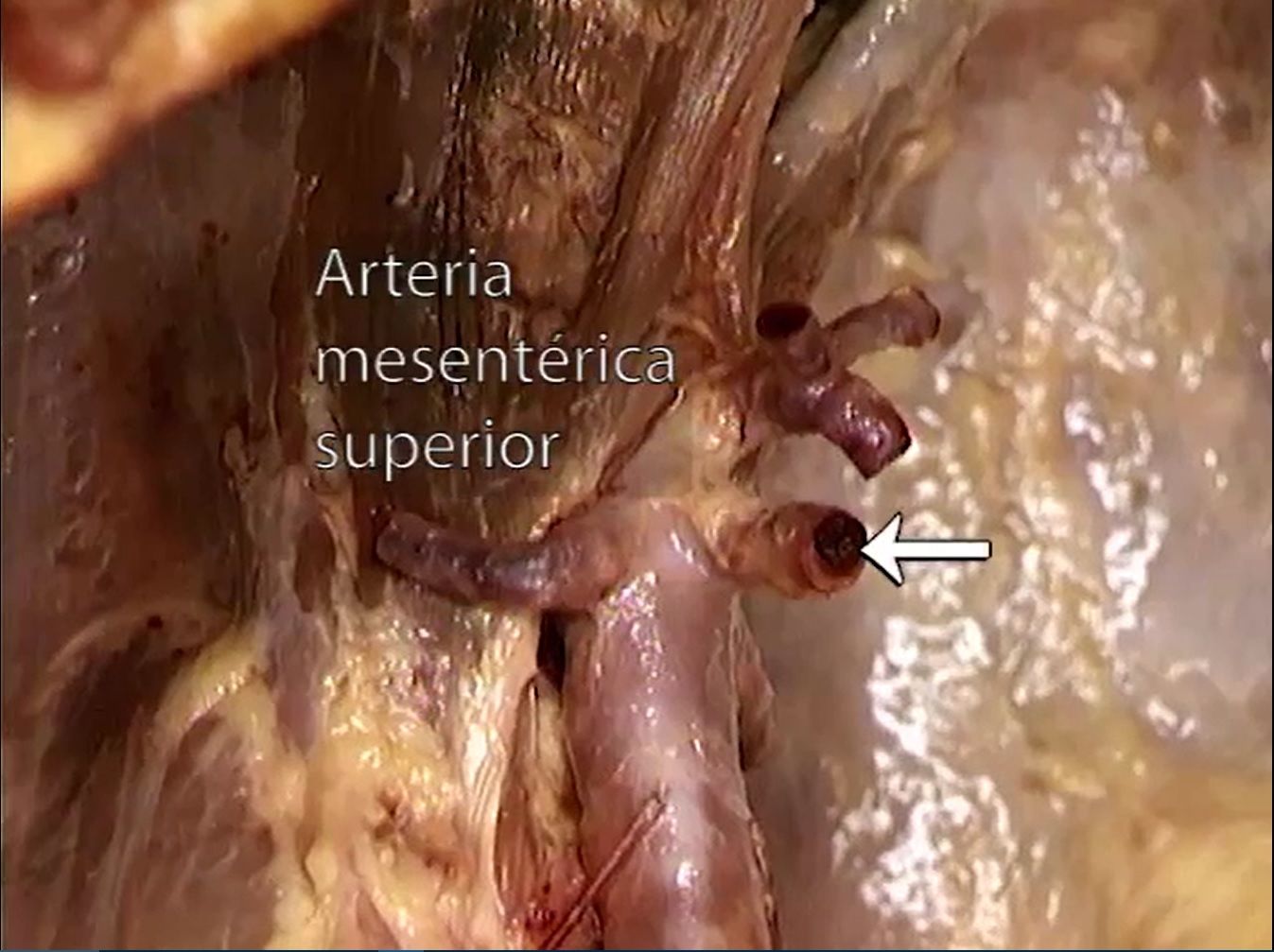Criculación del Abdomen