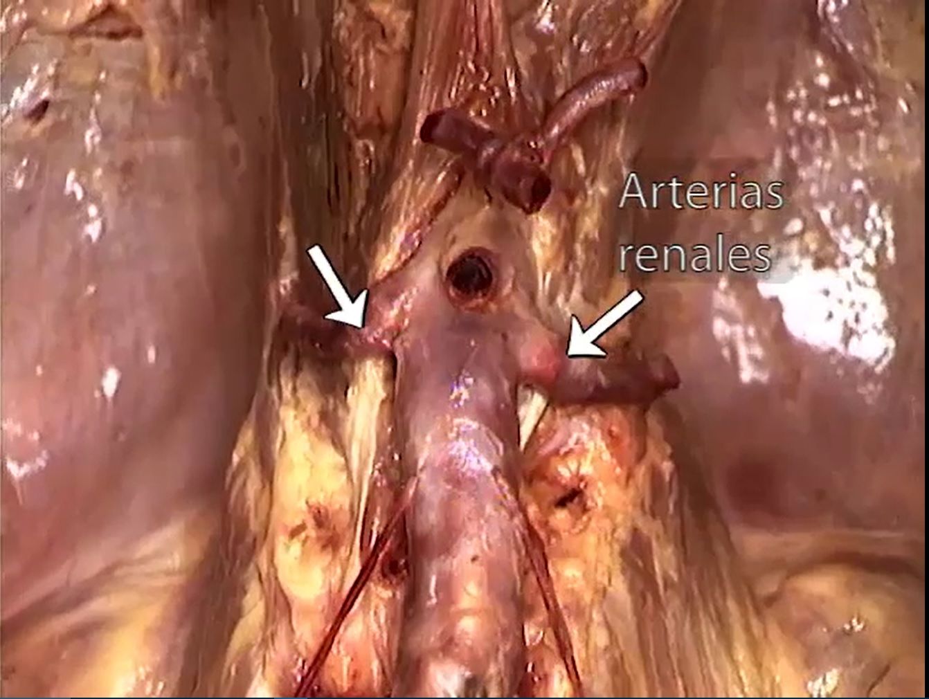 Criculación del Abdomen