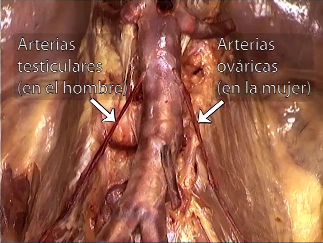 Criculación del Abdomen