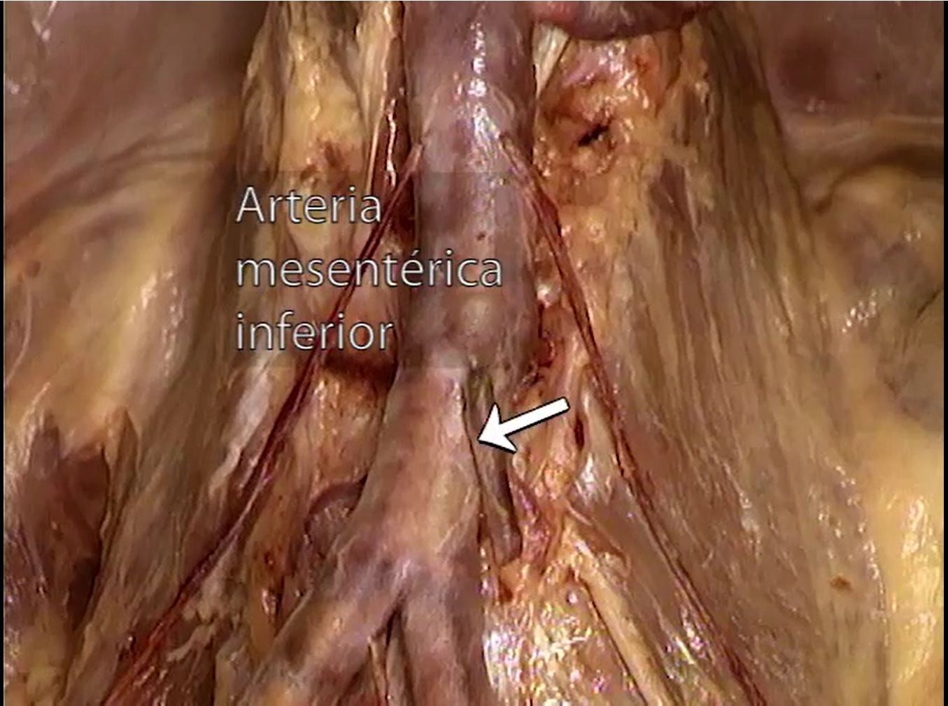 Criculación del Abdomen