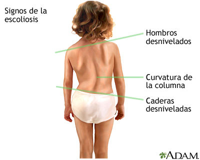 Aprendices con Necesidades Fisicas Especiales y con deterioros en la Salud