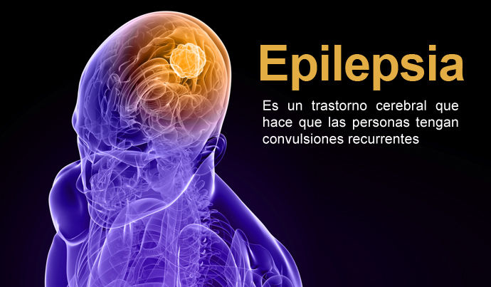Aprendices con Necesidades Fisicas Especiales y con deterioros en la Salud