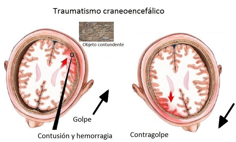 Aprendices con Necesidades Fisicas Especiales y con deterioros en la Salud