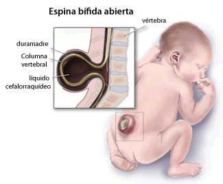 Aprendices con Necesidades Fisicas Especiales y con deterioros en la Salud