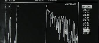 MODOS DE TRABAJO EN EQUIPOS DEULTRASONIDO