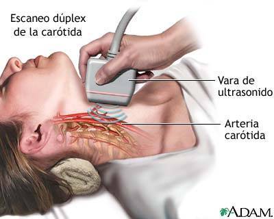 MODOS DE TRABAJO EN EQUIPOS DEULTRASONIDO