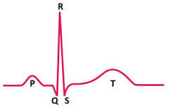 Trastornos de la frecuencia y el ritmo cardiaco