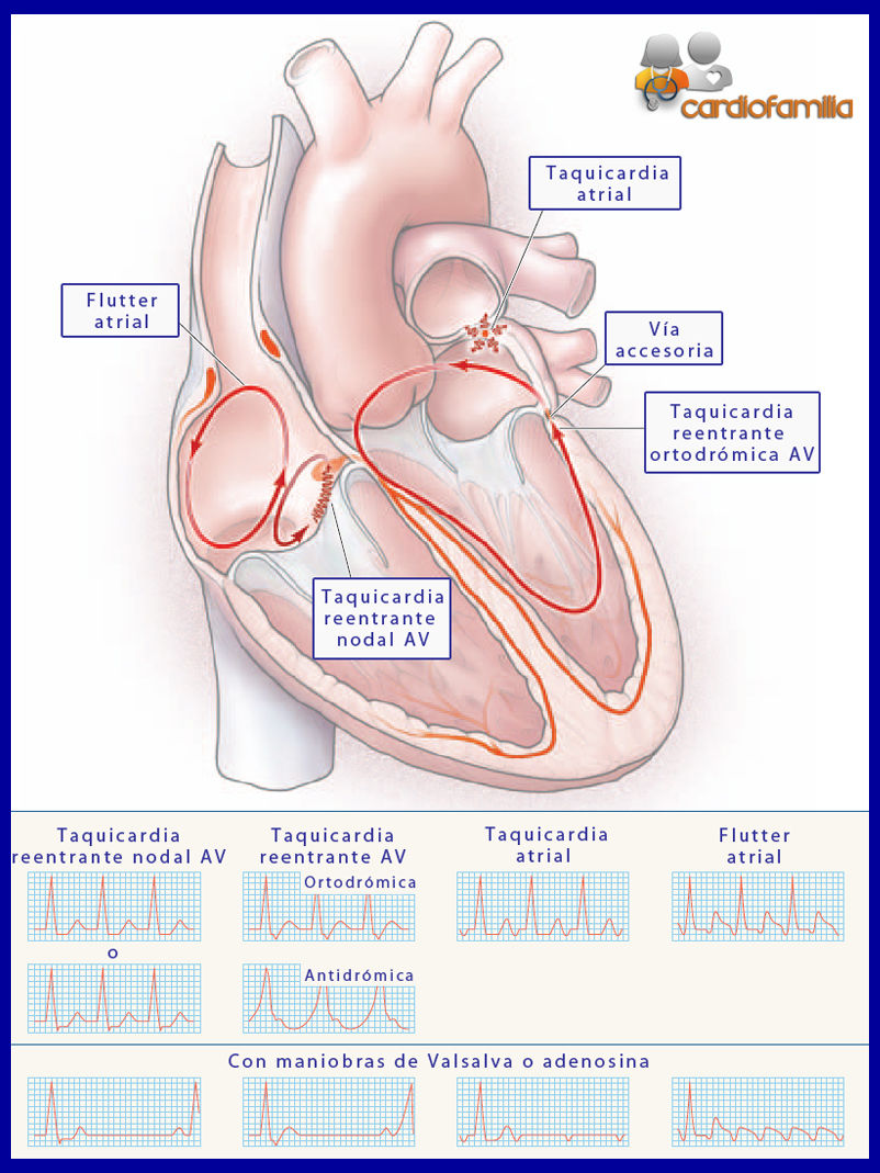 Trastornos de la frecuencia y el ritmo cardiaco