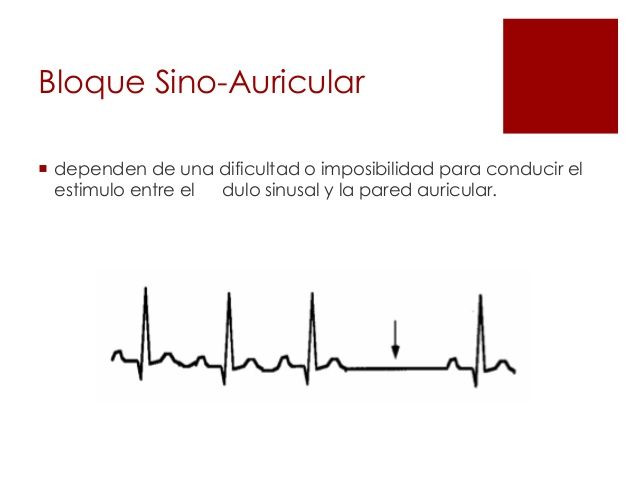 Trastornos de la frecuencia y el ritmo cardiaco