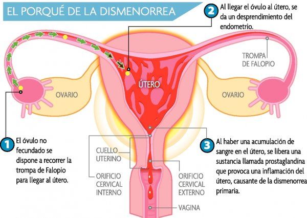 DOLOR PÉLVICO Y DISMENORREA. INFECCIONES GENITOURINARIAS Y ENFERMEDADES SEXUALMENTE