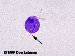 DOLOR PÉLVICO Y DISMENORREA. INFECCIONES GENITOURINARIAS Y ENFERMEDADES SEXUALMENTE