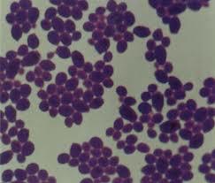 DOLOR PÉLVICO Y DISMENORREA. INFECCIONES GENITOURINARIAS Y ENFERMEDADES SEXUALMENTE