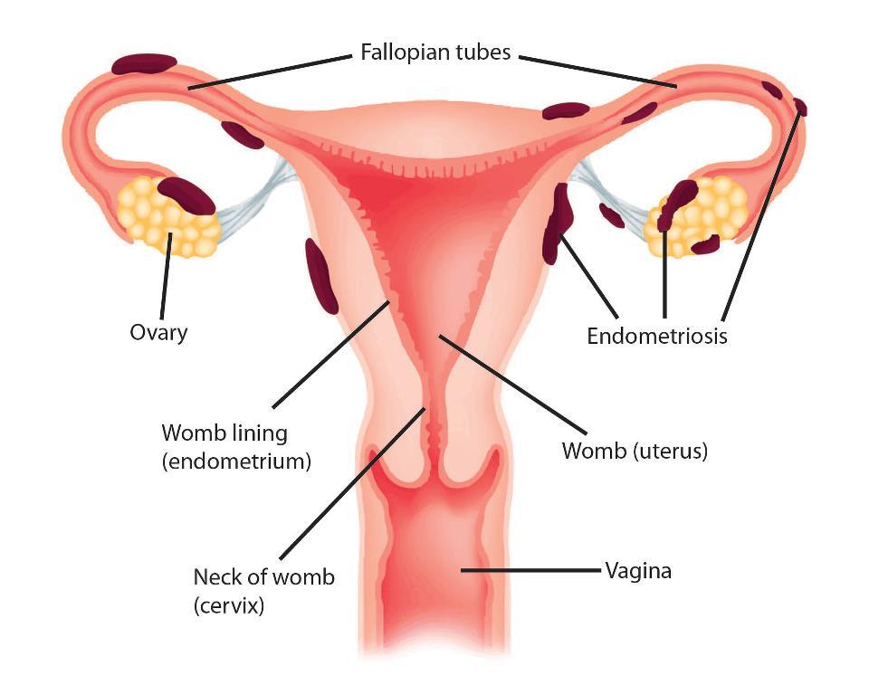 INFERTILIDAD, ABORTO TEMPRANO ESPONTANEO Y RECURRENTE