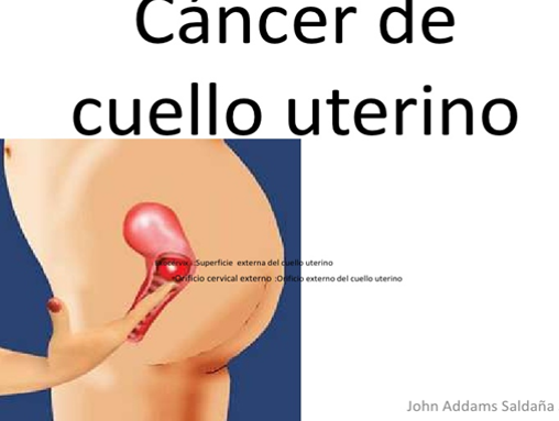 LINEAS DE-ACCION-ESTADO-COLOMBIANO PARA TRABAJO-SALUD-SEXUAL-REPRODUCTIVA