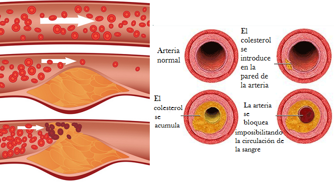 Enfermedades hipocineticas