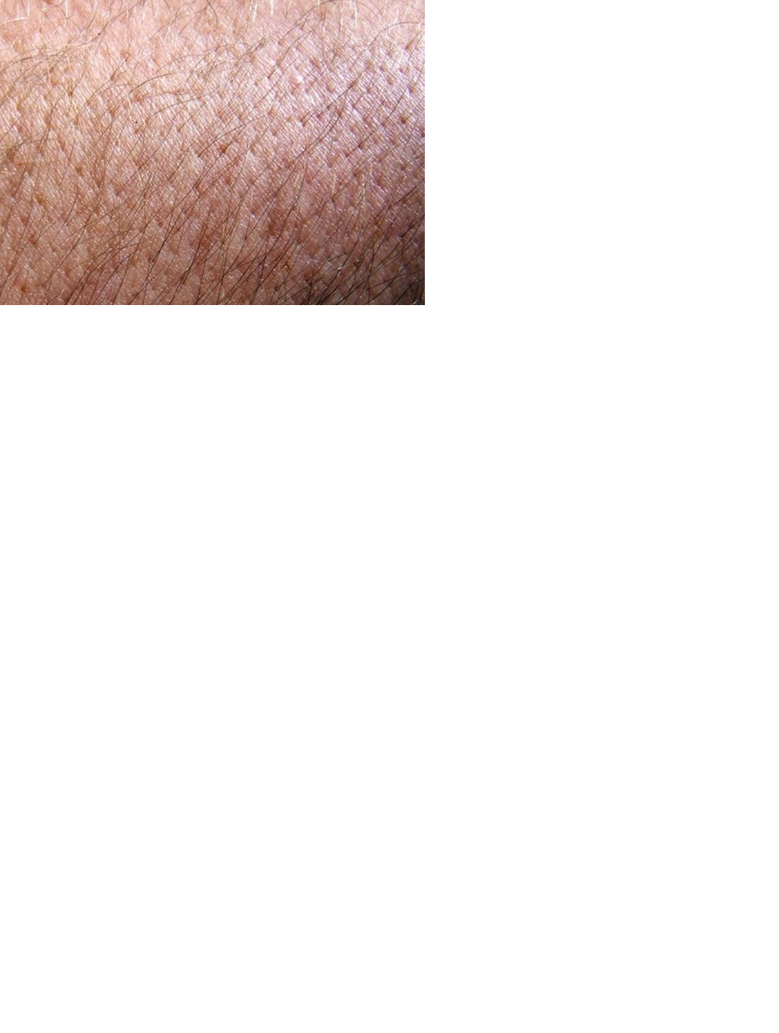 Módulo de Farmacovigilancia, Tecnovigilancia y Seguimiento Farmaceutico