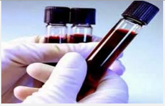 NOM-087-ECOL-SSA1-2002 Residuos peligrosos biológico-infecciosos