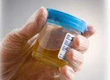 NOM-087-ECOL-SSA1-2002 Residuos peligrosos biológico-infecciosos