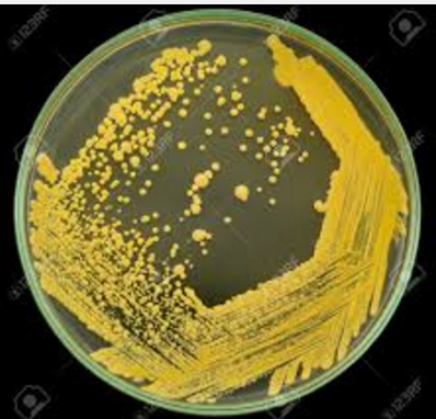 NOM-087-ECOL-SSA1-2002 Residuos peligrosos biológico-infecciosos