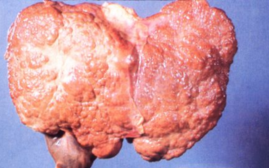 NOM-087-ECOL-SSA1-2002 Residuos peligrosos biológico-infecciosos