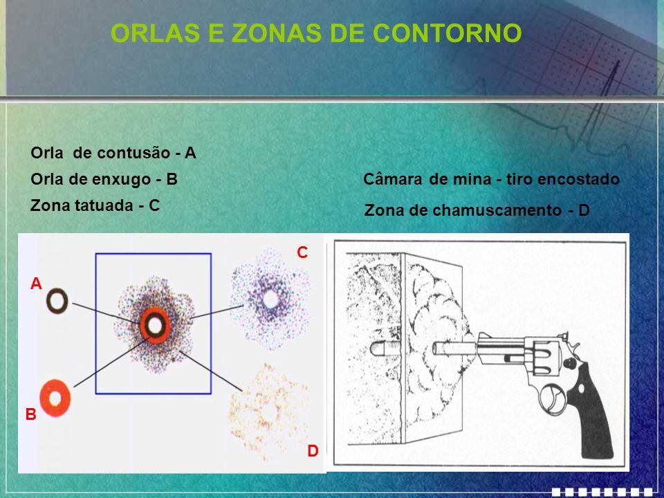 Lesões Produzidas por projéteis de armas de fogo (Perfurocontundentes)