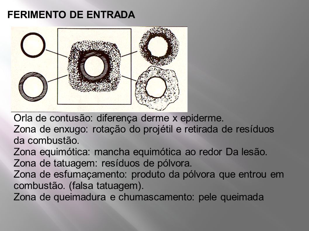 Lesões Produzidas por projéteis de armas de fogo (Perfurocontundentes)