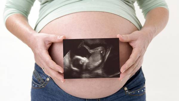 Familias que tienen hijos discapacitados discapacidad familia