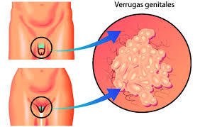 linea de acción de la salud sexual y reproductiva