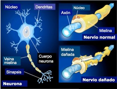 NEURODESARROLLO
