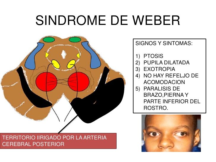 NEURODESARROLLO