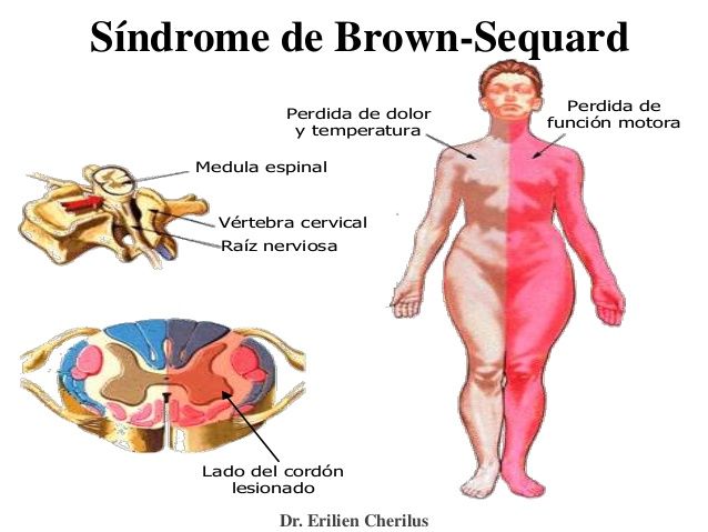 NEURODESARROLLO