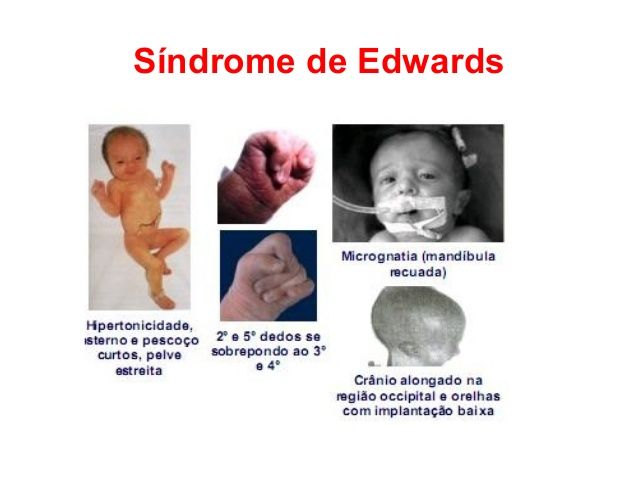 NEURODESARROLLO