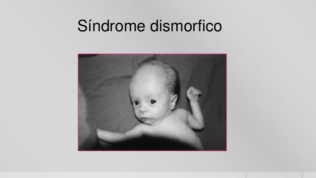 NEURODESARROLLO