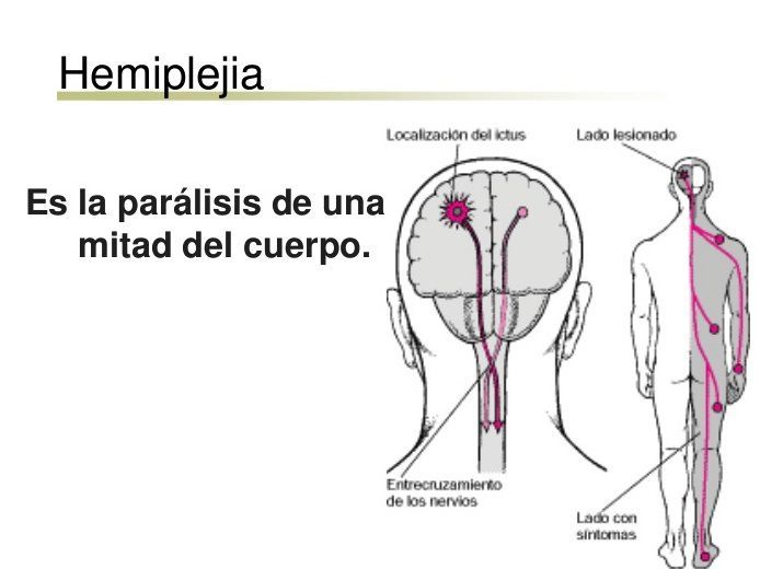 NEURODESARROLLO