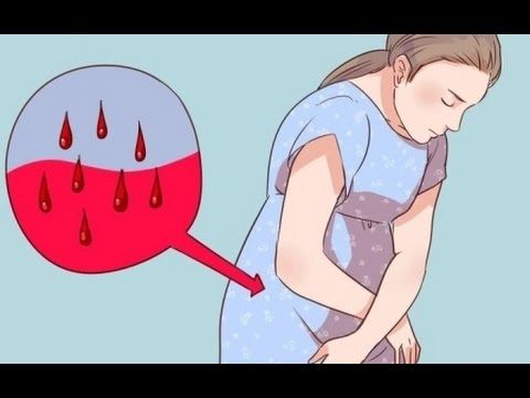 34. Enfermedades benignas del aparato reproductor femenino