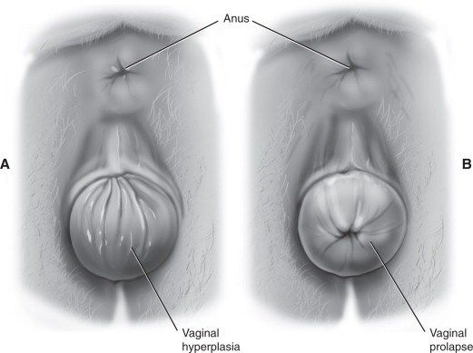 39. Incontinencia urinaria, prolapso genital, trastornos del piso pélvico